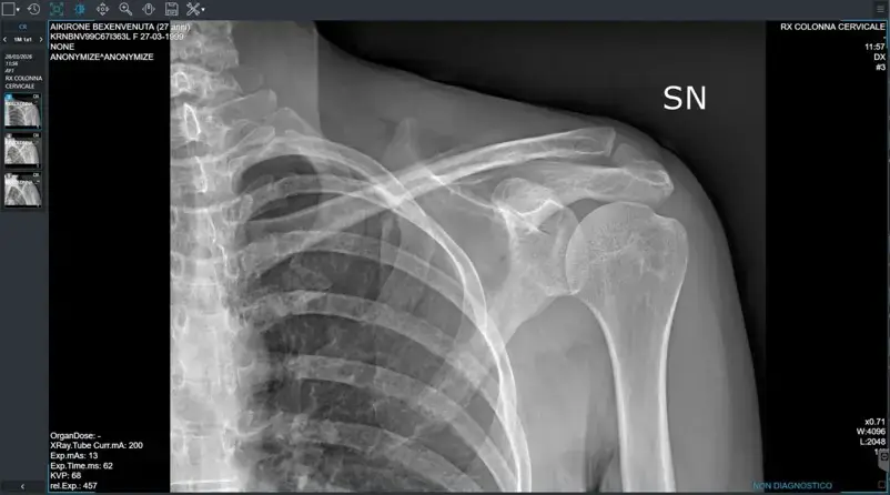 Sanità digitale, in Lombardia arrivano le immagini diagnostiche sul Fascicolo Sanitario Elettronico